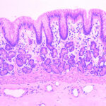 microscopic image of malignant FFPE human tissue sample