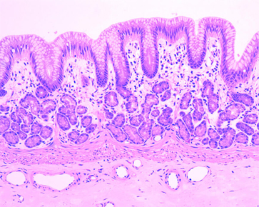 microscopic image of malignant FFPE human tissue sample
