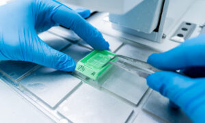 Lab technician preparing a FFPE control tissue slide