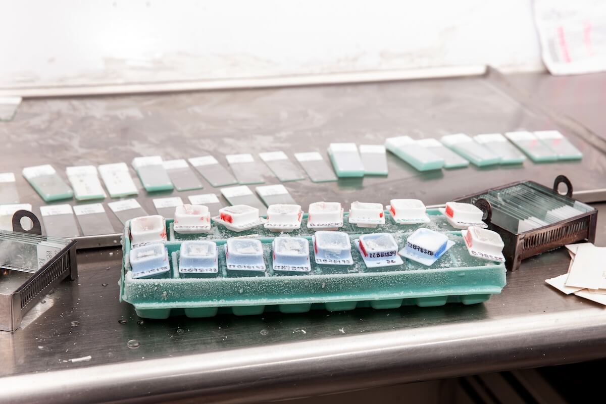 A tray on lab table carrying ffpe blocks, slides, and sections