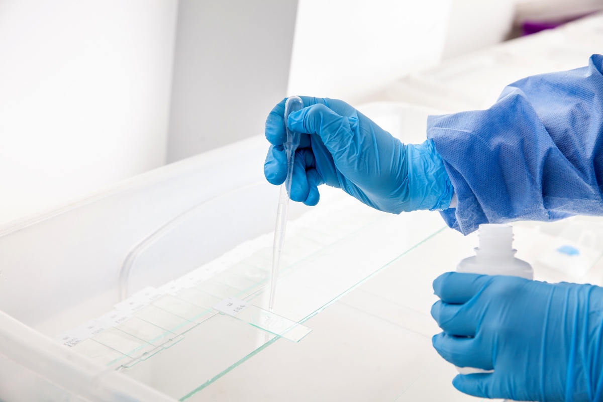 Scientist preparing slides with paraffin embedded tissue samples for immunohistochemistry assay in the laboratory.