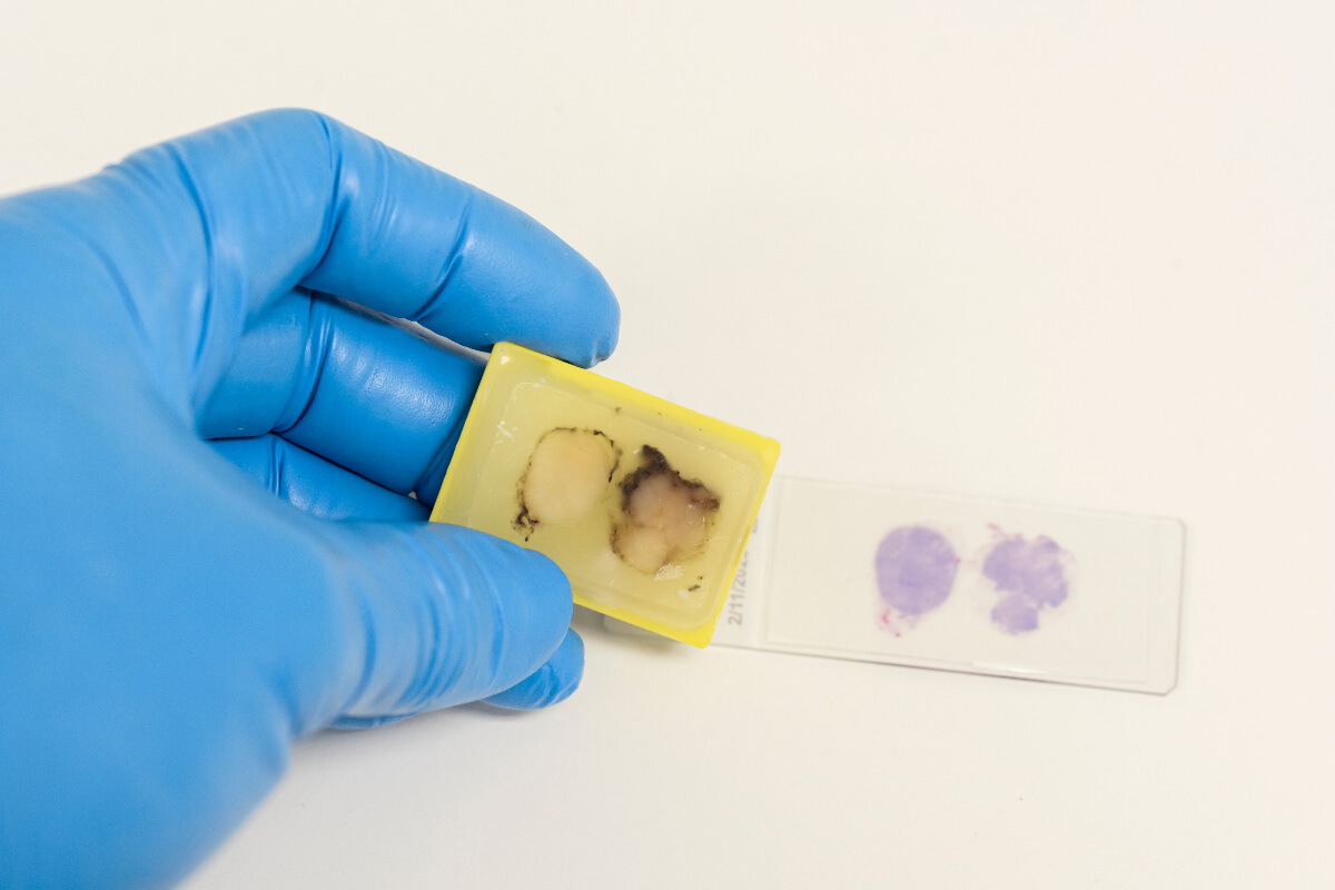 Lab technician holding and comparing histological samples