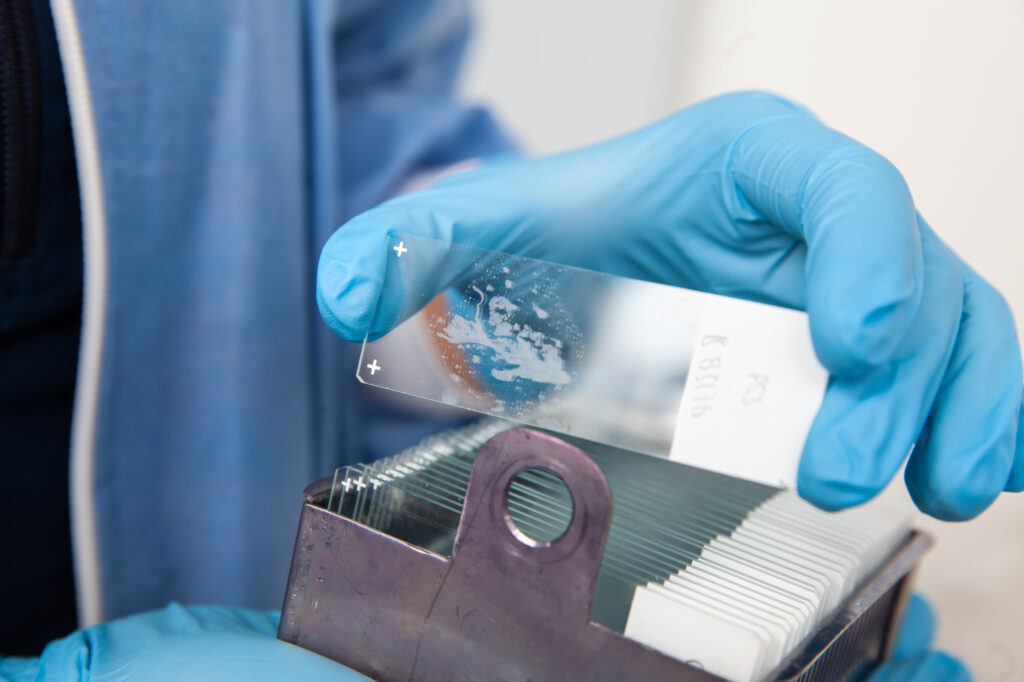 Scientist placing slides with paraffin embedded tissue samples into a slide staining rack for dual staining.