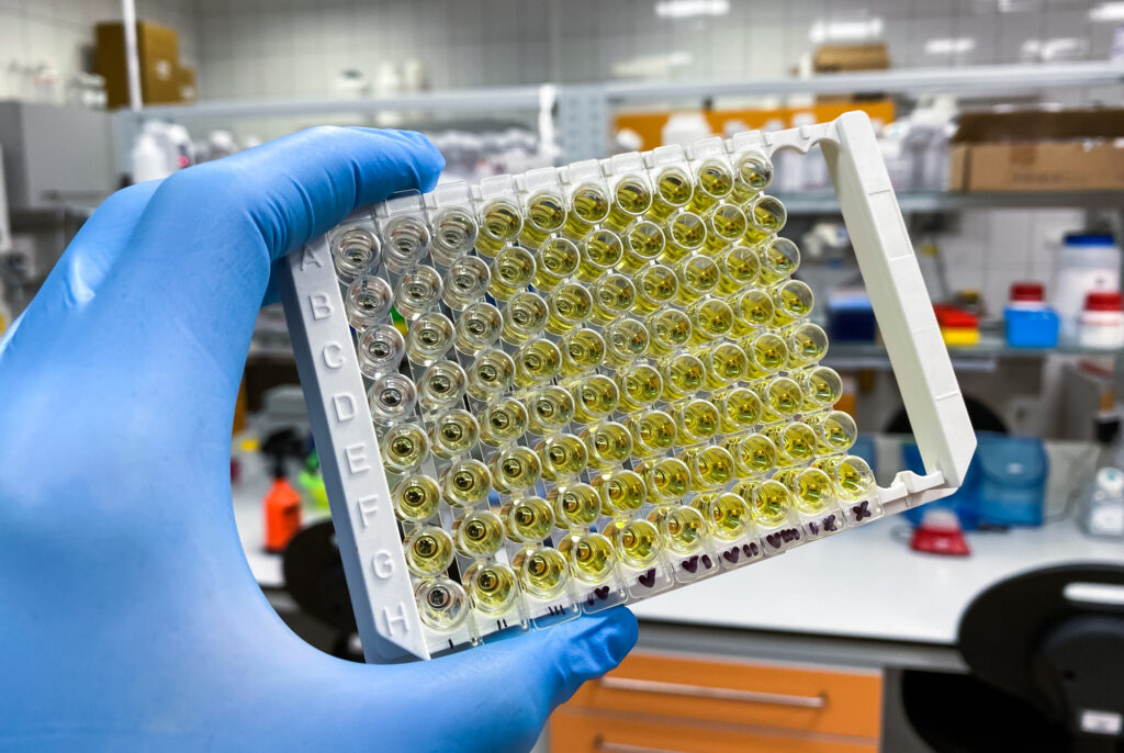 Senior medical diagnostician holding an ELISA test plate used to discover cancer biomarkers as part of personalized and precision medicine.