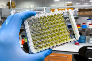 Senior medical diagnostician holding an ELISA test plate used to discover cancer biomarkers as part of personalized and precision medicine.
