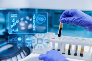Blood plasma test tube for digital pathology and AI data overlay.